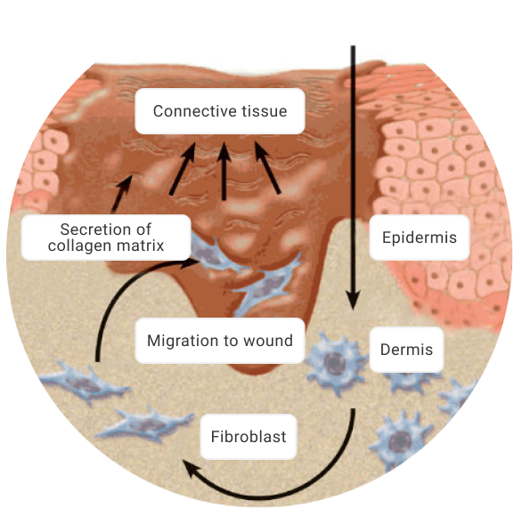 Bioptron light therapy device used near a healing wound for recovery support