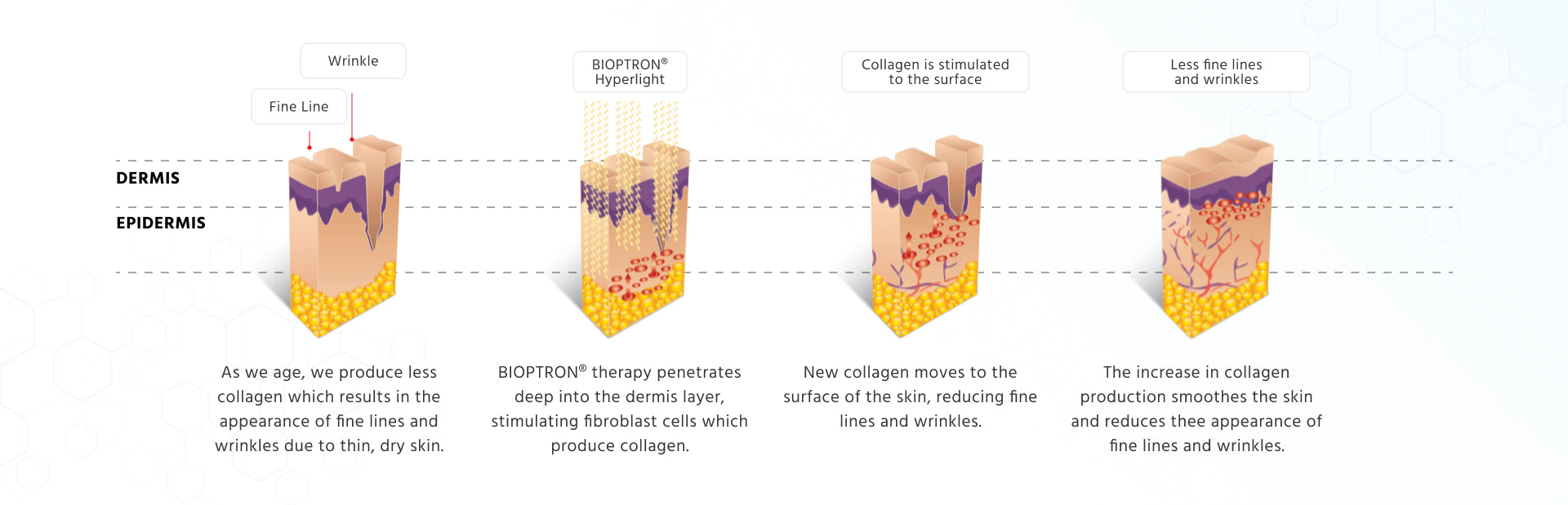 Bioptron light therapy device for healthy ageing and skin support