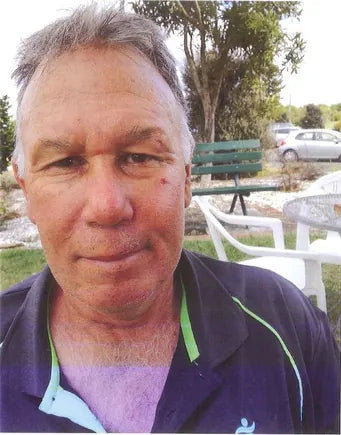 Facial Injury After Bike Fall