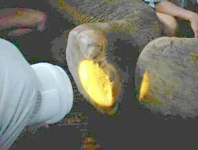 Kashin: Arthritis, Wound and Pressure Sore