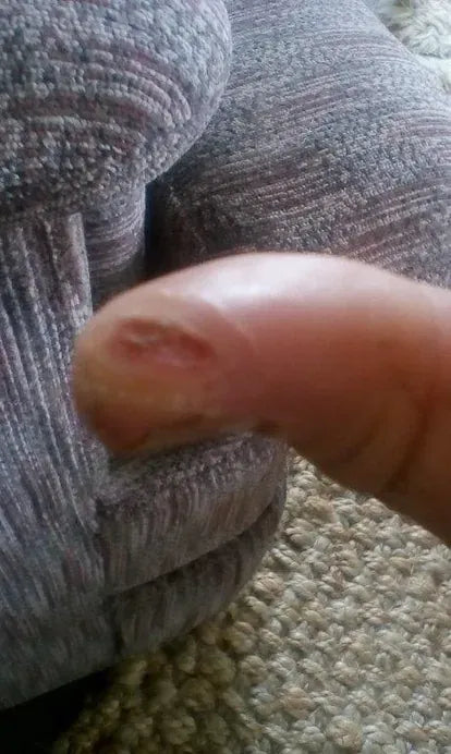 Sliced Thumb From Horse Tooth