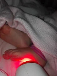 Toddler Eczema After Chicken Pox